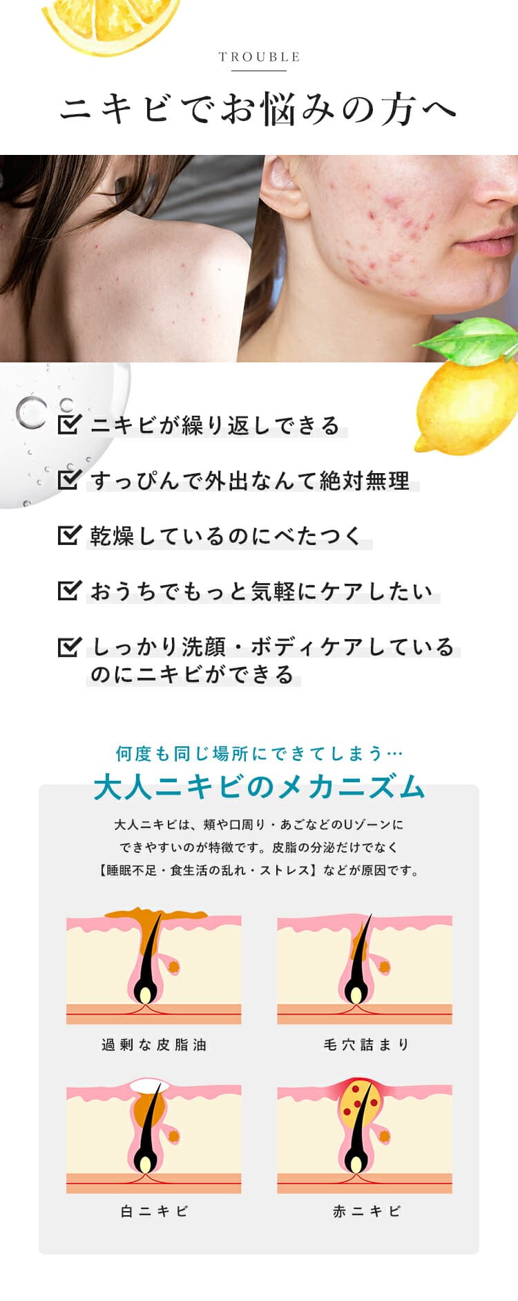 暗瘡專科 藥用美白修護霜 圖 1